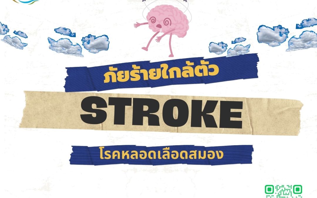 ภัยร้ายใกล้ตัว Stroke โรคหลอดเลือดสมอง